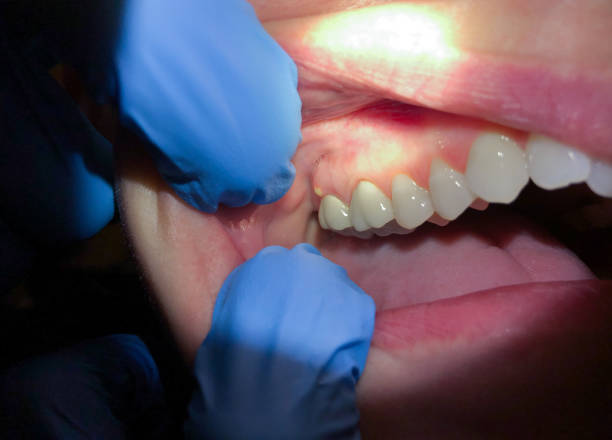 Best Emergency Dental Care for Sports Injuries in Gamerco, NM
