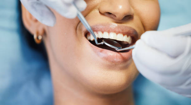 Best Emergency Cosmetic Dentistry (e.g., broken veneers) in Gamerco, NM