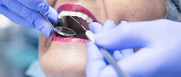 Best Knocked-Out Tooth (Avulsed Tooth) Treatment in Gamerco, NM